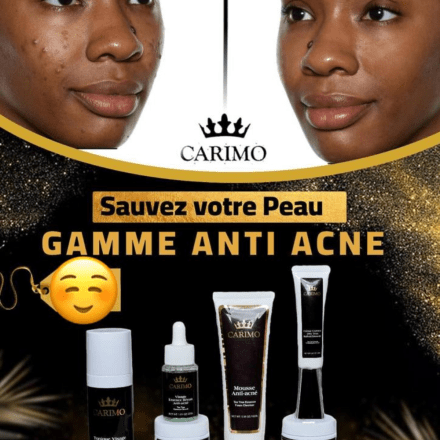Routine anti-acné : 3 produits efficaces contre boutons